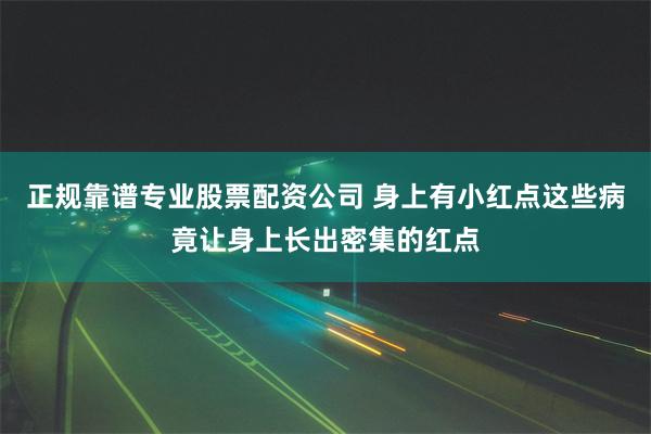 正规靠谱专业股票配资公司 身上有小红点这些病竟让身上长出密集的红点